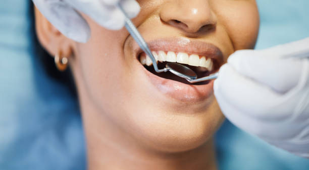 Best Emergency Wisdom Tooth Extraction in Lenoir, NC