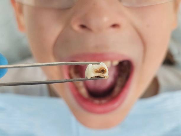 Best Emergency Care for Gum Disease in Lenoir, NC